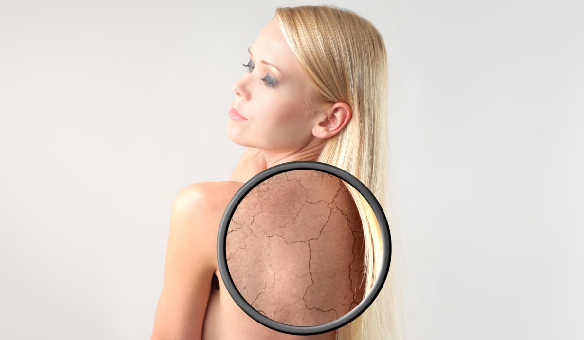 Negatywny wpływ twardej wody na skórę i włosy